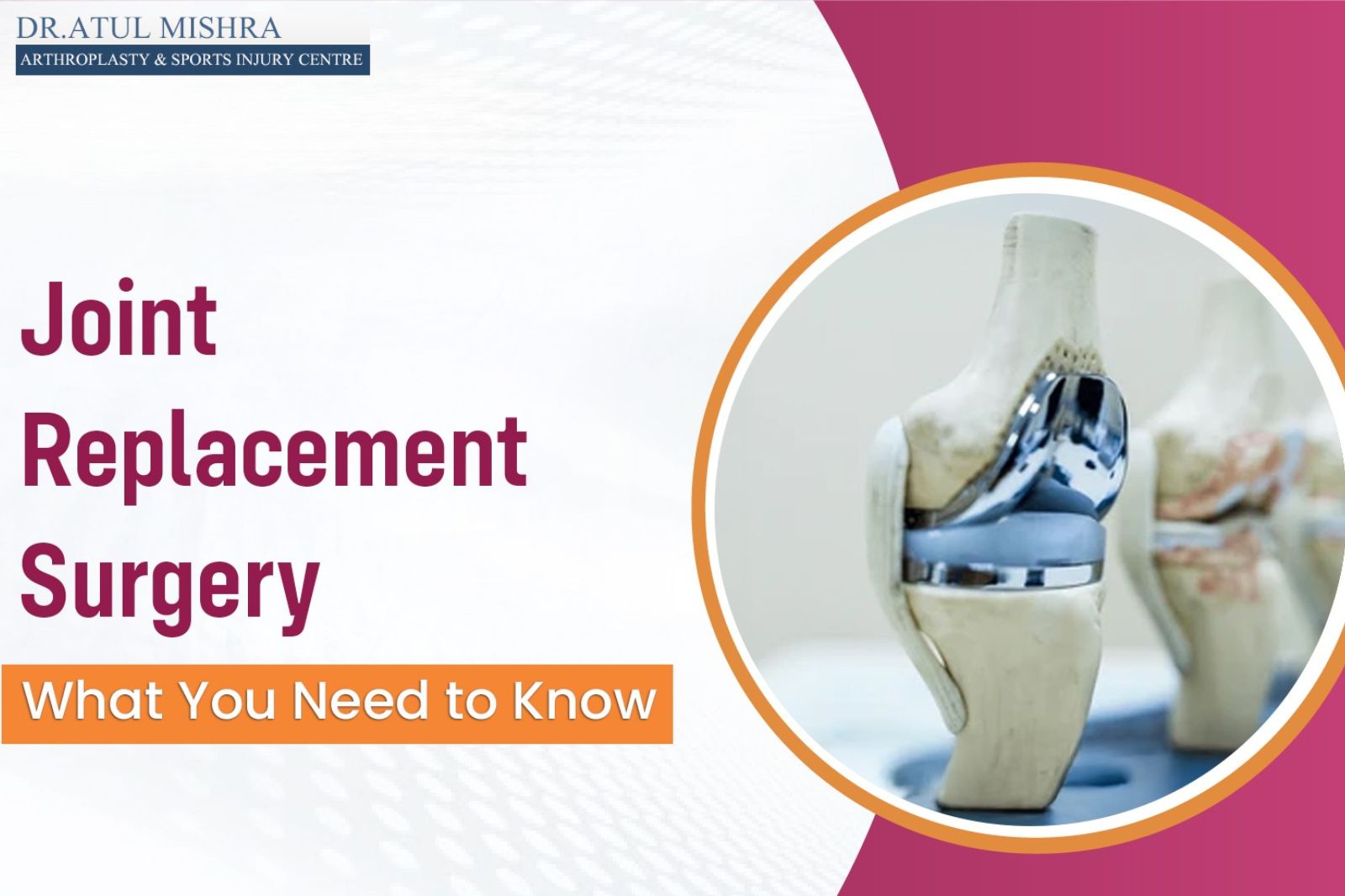 joint replacement surgery in delhi